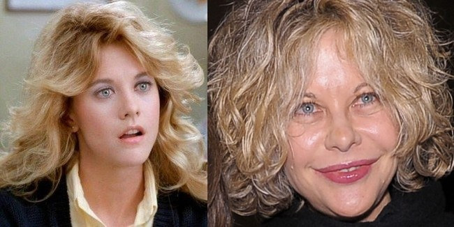 Meg Ryan xinh đẹp của ngày hôm qua giờ đã trở nên méo mó với botox. Meg Ryan
