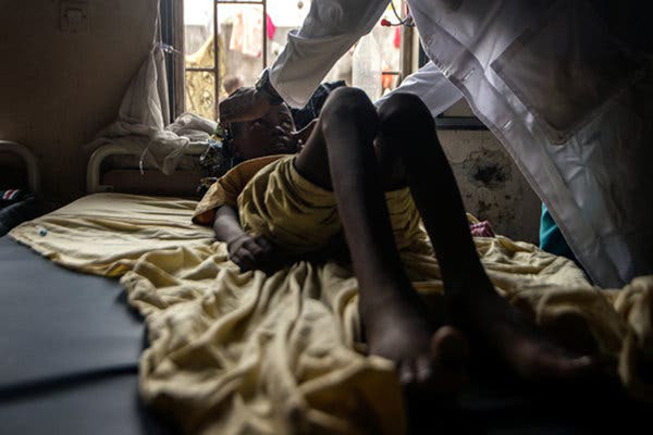 SCD gây thiếu máu, mệt mỏi và đau đớn khủng khiếp. SCD gây thiếu máu, mệt mỏi và đau đớn khủng khiếp.