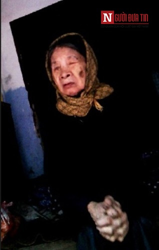 Xót lòng mẹ già 85 tuổi mù lòa nuôi con gái thần kinh - Ảnh 4