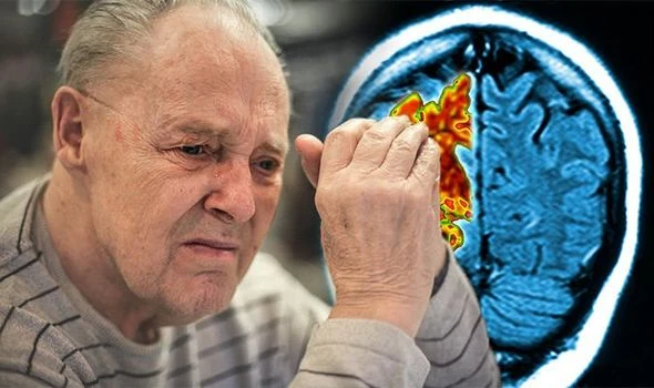 Người già dễ mắc bệnh Alzheimer.