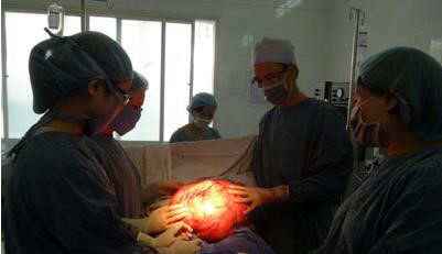 Cắt bỏ khối u lớn đeo 22 năm trên cơ thể người phụ nữ khiếm thị - Ảnh 1 Cat bo khoi u lon deo 22 nam tren co the nguoi phu nu khiem thi - Anh 1