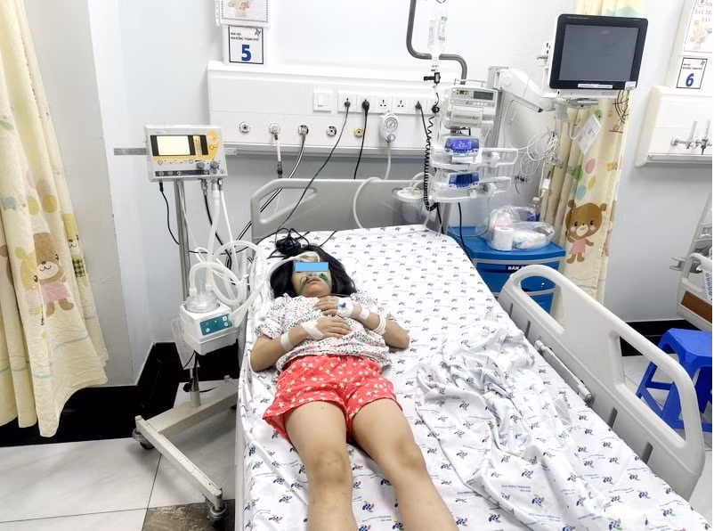 Một trường hợp trẻ đuối nước được điều trị tại Bệnh viện Nhi đồng TPHCM. Ảnh: BVCC.