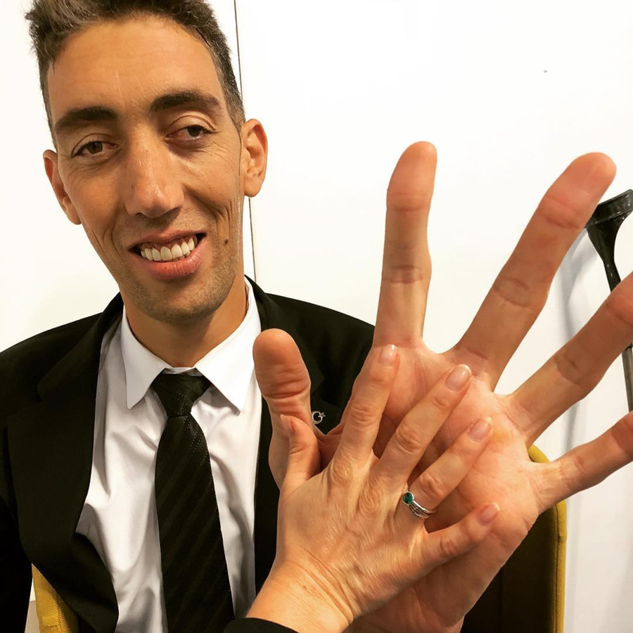 Sultan Kösen cũng giữ kỷ lục là người có bàn tay, bàn chân dài nhất.