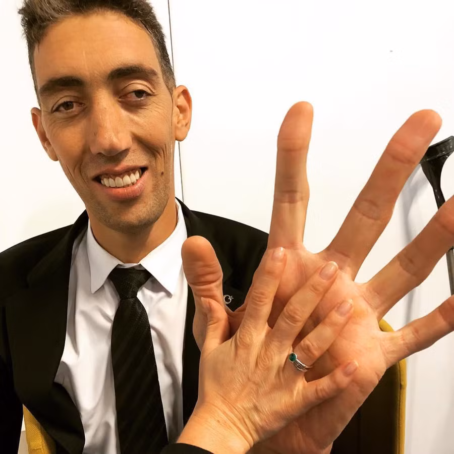 Sultan Kösen cũng giữ kỷ lục là người có bàn tay, bàn chân dài nhất.