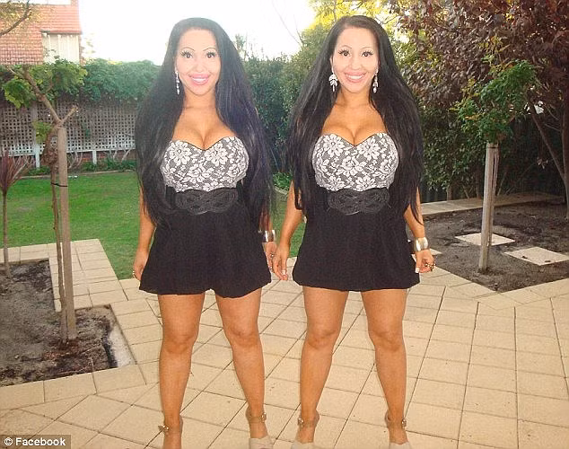 Cả hai còn quyết định đi phẫu thuật nâng ngực, bơm môi cùng nhau.