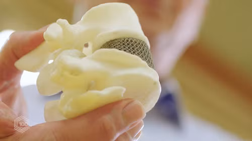 Một mẫu cấy ghép xương in 3D. Một mẫu cấy ghép xương in 3D.