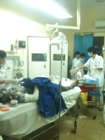 Vụ 6 người bị bỏng bất thường: Khởi tố, bắt tạm giam 2 đối tượng ảnh 1 Ảnh minh họa