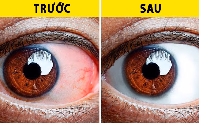 Thị lực suy giảm mạnh do lạm dụng công nghệ: 8 bài tập thể dục tốt nhất để “cứu” đôi mắt