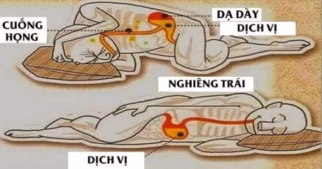 Day la li do tai sao ban nen nam ngu nghieng ve ben trai ngay toi nay - Anh 1