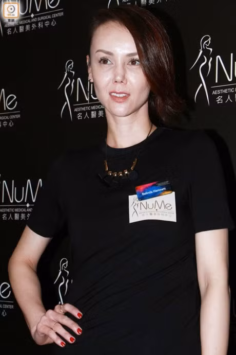 Su that ve chiec mui bi lech cua Hoa hau HongKong - Anh 1