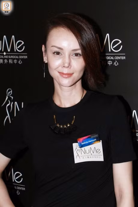 Su that ve chiec mui bi lech cua Hoa hau HongKong - Anh 2