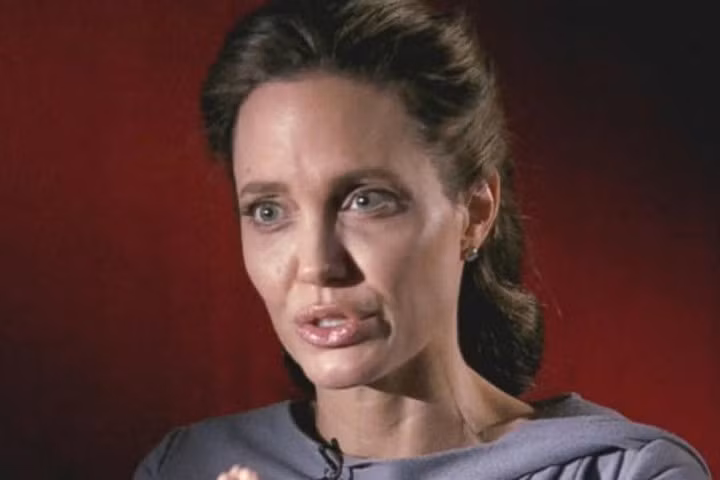 Angelina Jolie bị rối loạn ăn uống, chỉ còn 34 kg sau khi ly hôn?