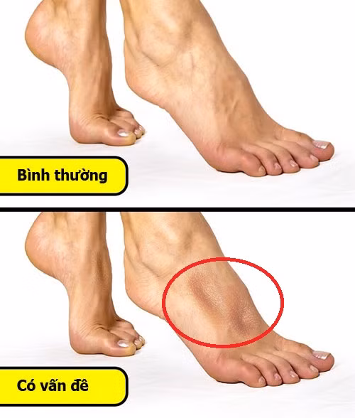 7 bước nhanh gọn giúp bạn khám sức khoẻ tổng quát miễn phí ngay tại nhà ảnh 6