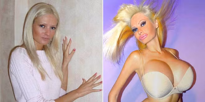 Những ca phẫu thuật thẩm mỹ gây sốc nă​m 2014 ảnh 7