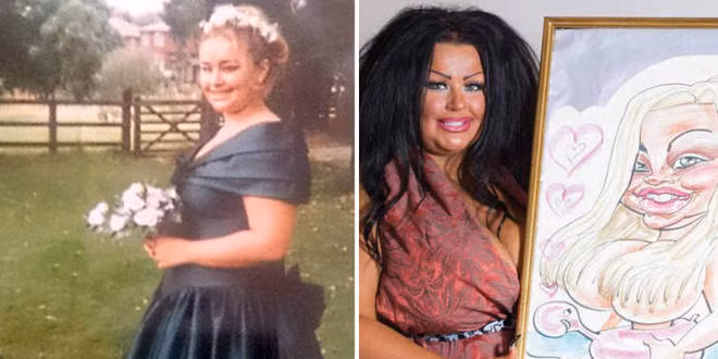 Những ca phẫu thuật thẩm mỹ gây sốc nă​m 2014 ảnh 9