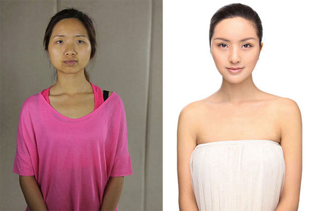 Những ca phẫu thuật thẩm mỹ gây sốc nă​m 2014 ảnh 10