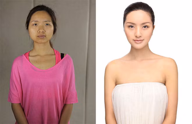 Những ca phẫu thuật thẩm mỹ gây sốc nă​m 2014 ảnh 10