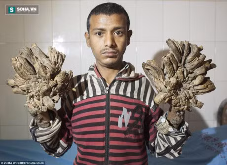 Nhung can benh ky la nhat the gioi - Anh 4