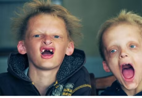 Nhung can benh ky la nhat the gioi - Anh 6