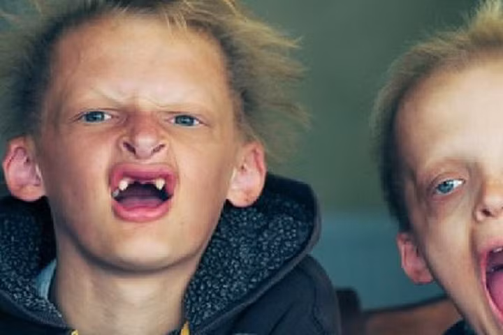 Những căn bệnh kỳ lạ nhất thế giới