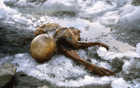 Người băng Otzi và những phát hiện mới có ích cho y học - Ảnh 3 Nguoi bang Otzi va nhung phat hien moi co ich cho y hoc - Anh 3