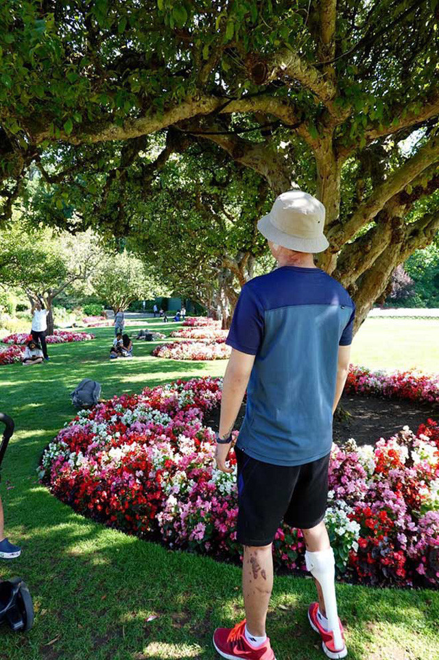 Hình ảnh mới của Việt kiều Canada sau gần 1 năm bị cắt gân chân và tạt axit khi về quê ăn Tết - Ảnh 6. Hình ảnh mới của Việt kiều Canada sau gần 1 năm bị cắt gân chân và tạt axit khi về quê ăn Tết - Ảnh 6.