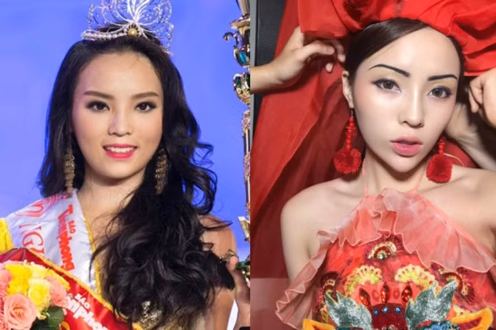 Mỹ nhân Việt và gương mặt cứng đơ như tượng sáp