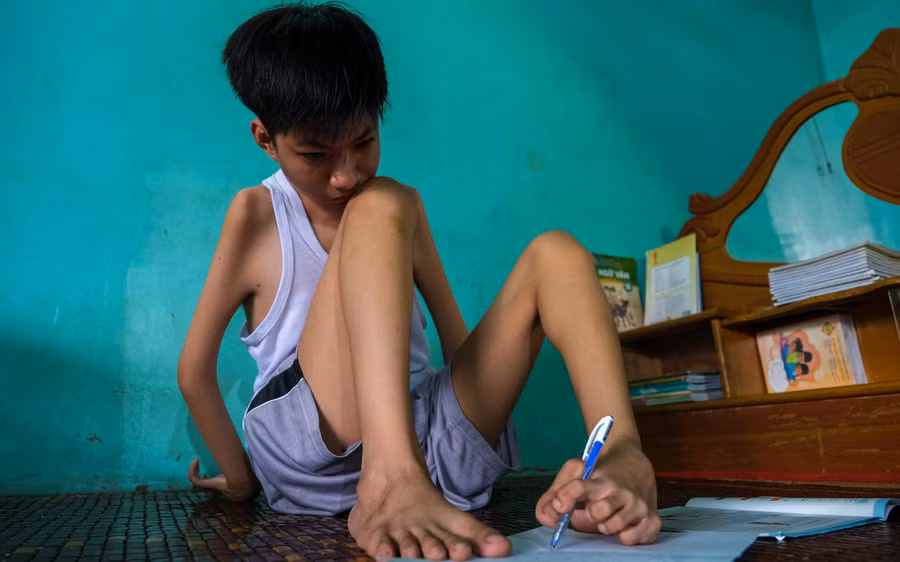 Trung luôn cố gắng học tập để sau này có được công việc phù hợp tự lo cho bản thân.