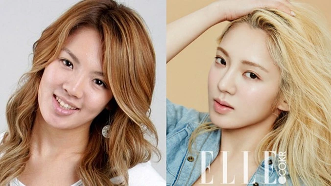 12 sao Kpop lộ phẫu thuật thẩm mỹ vì ảnh quá khứ