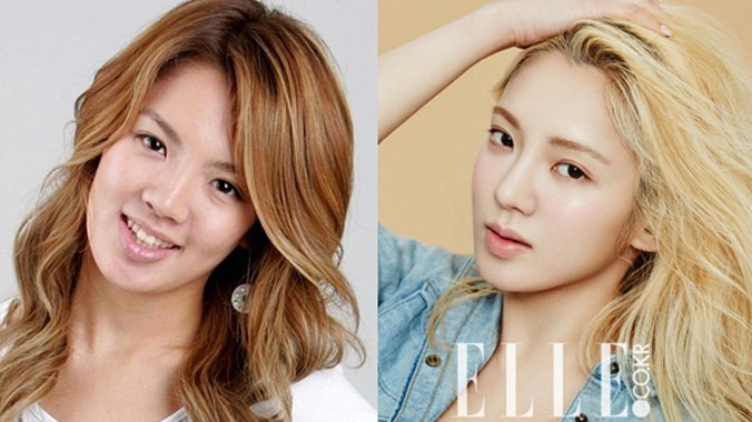 12 sao Kpop lộ phẫu thuật thẩm mỹ vì ảnh quá khứ