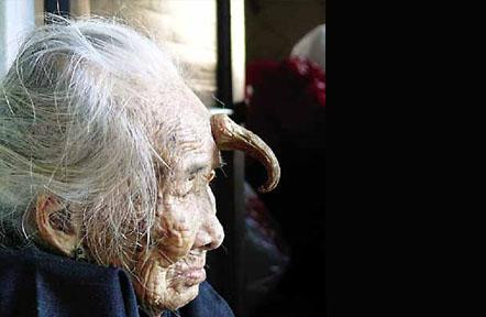 Kỳ bí chuyện cụ ông bị mọc sừng trên đầu sau giấc mơ lạ