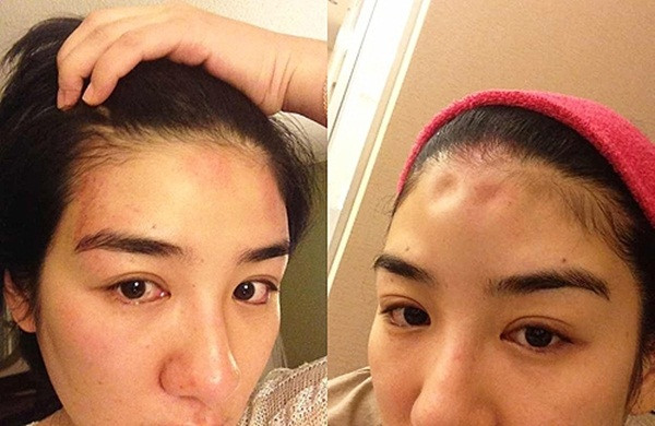 Những nữ nghệ sĩ từng bị bạo hành ảnh 7 Đau xót những nữ nghệ sĩ bị chồng bạo hành