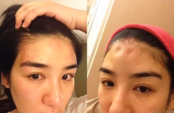 Đau xót những nữ nghệ sĩ bị chồng bạo hành