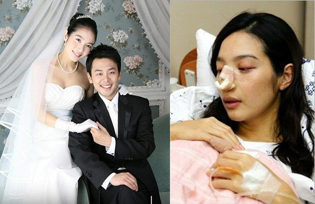 Những nữ nghệ sĩ từng bị bạo hành ảnh 2 Đau xót những nữ nghệ sĩ bị chồng bạo hành