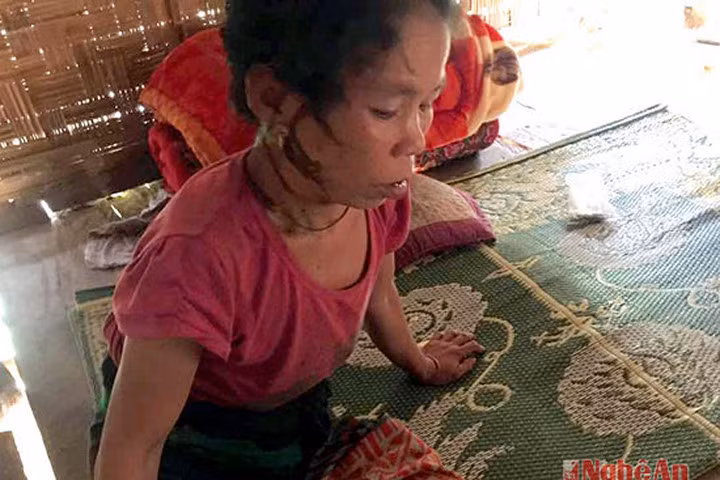 Vào rừng lấy củi, hai mẹ con bị ong rừng vây đốt