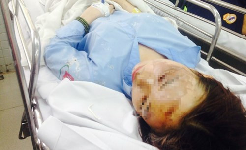 Thuê người tạt a xít 2 nữ sinh vì ghen tuông đồng tính ảnh 2