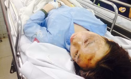 Thuê người tạt a xít 2 nữ sinh vì ghen tuông đồng tính ảnh 2