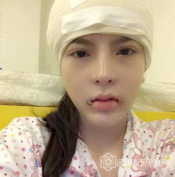 phau-thuat-tham-my-2 25