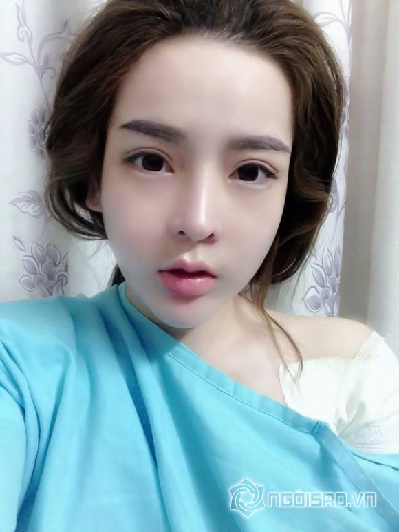 phau-thuat-tham-my-9 18