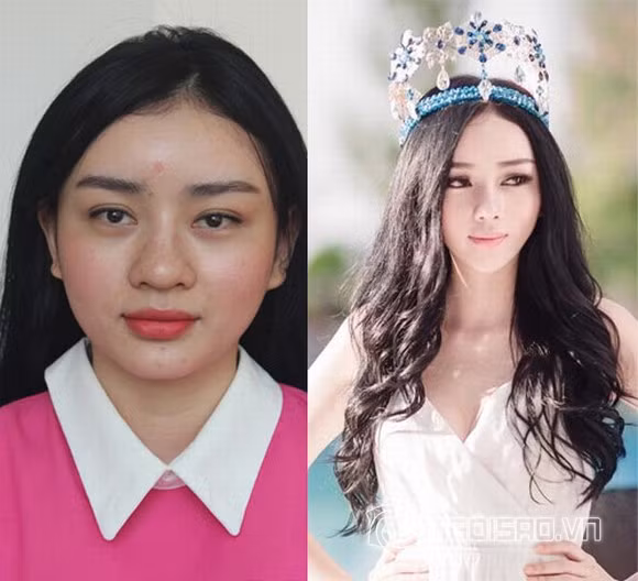 Những cô gái Việt vô danh nổi tiếng nhờ ""nghiện dao kéo""