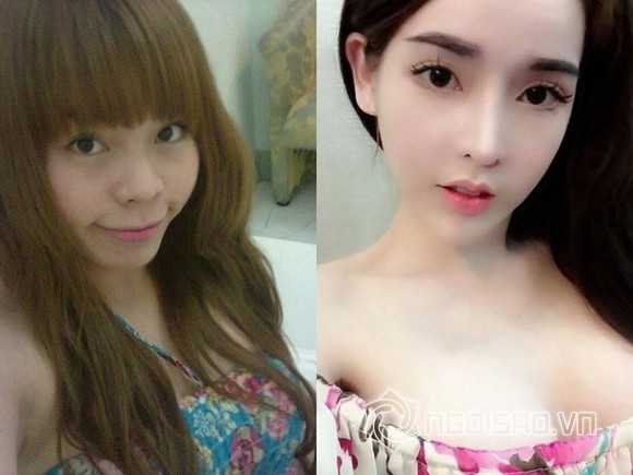 phau-thuat-tham-my-11 16