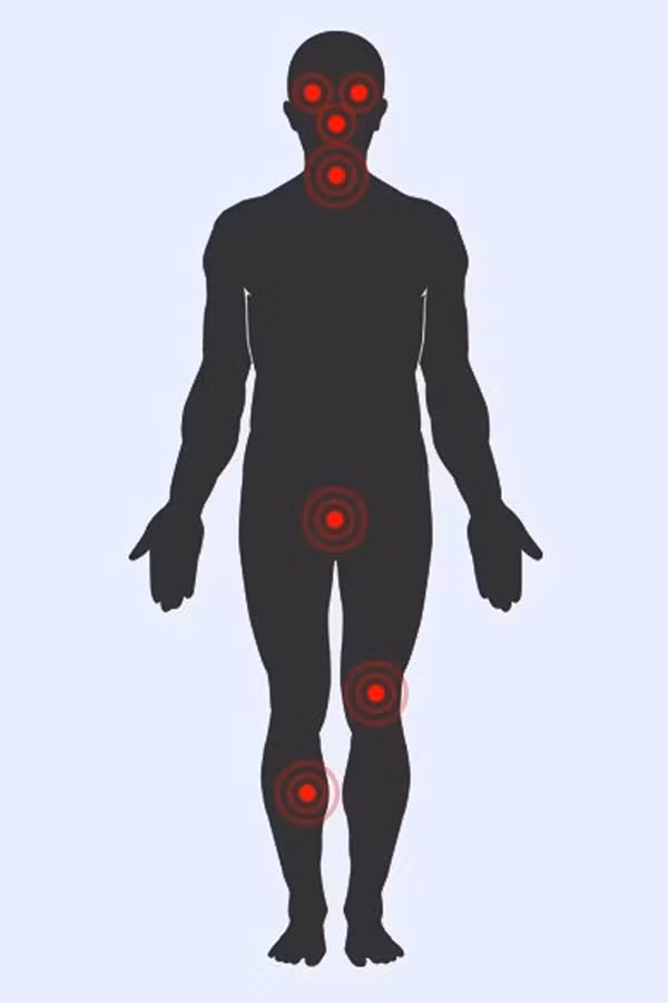 Những kỹ năng tự vệ phụ nữ nên trang bị để thoát nạn khi gặp nguy hiểm