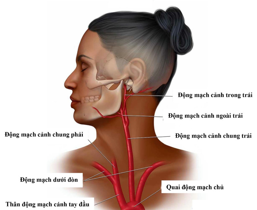 Động mạch cảnh trong đoạn đi ở cổ. Động mạch cảnh trong đoạn đi ở cổ.