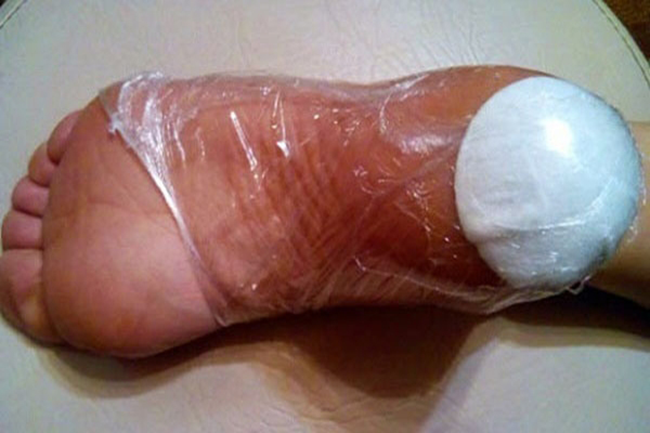 Gót chân nứt nẻ cách mấy cũng nhẵn mịn nếu quấn chân thế này ảnh 2 Gót chân nứt nẻ cách mấy cũng nhẵn mịn nếu quấn chân thế này ảnh 2