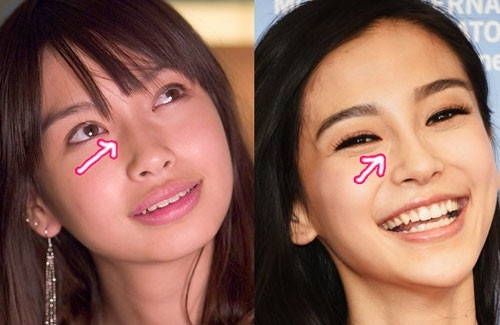 Đôi mắt một mí trước đây cũng thay đổi, phần nhiều do cách trang điểm, nhưng nhiều người tin rằng Angelababy đã sửa mí mắt cho hài hòa gương mặt.