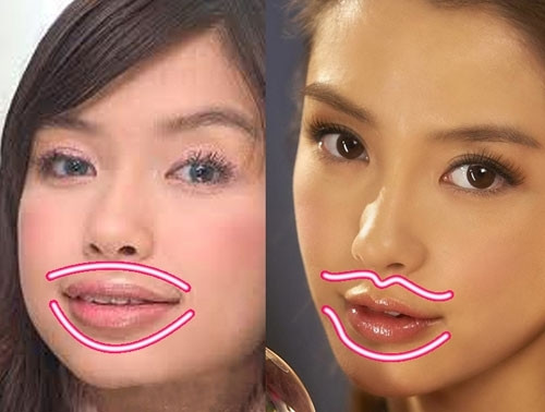 Môi trên và dưới của diễn viên Tai Chi Zero trước đây đầy đặn và có tạo hình tròn chứ không phải trái tim như hiện tại.