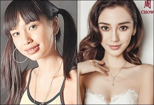 Angela Baby và những hình ảnh khi chưa phẫu thuật thẩm mỹ