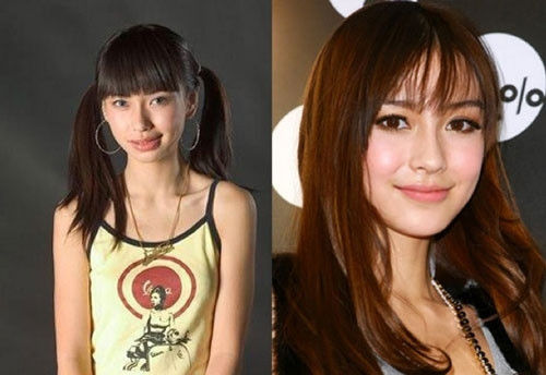 Một trong những thay đổi rõ rệt của Angelababy là chiếc cằm. Trước đây, cằm cô ngắn và tròn chứ không thon nhọn như bây giờ. Diễn viên xinh đẹp có thể sử dụng phương pháp cấy ghép, tái định vị lại cằm cho các đường nét gương mặt hài hòa, cân đối hơn.
