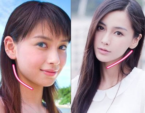 Hàm bạnh khiến gương mặt to và thô hơn nên Angelababy đã thay đổi vào năm 2011.