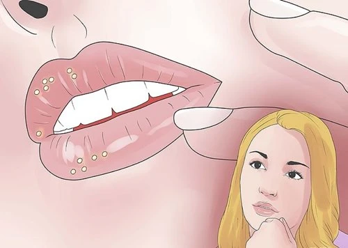 Dấu hiệu nhận biết bệnh giang mai